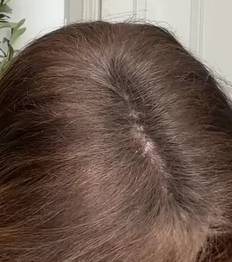 After: the same part with the scalp covered