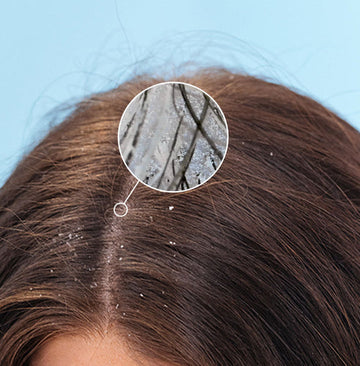 Your scalp health: Could it be preventing your hair from growing?