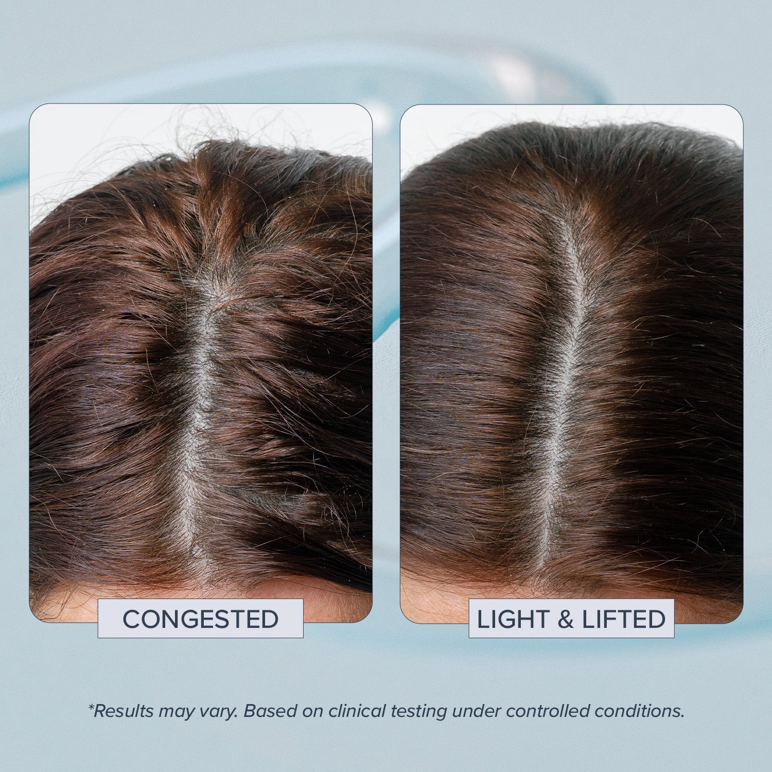 Head Start Scalp Ampoule