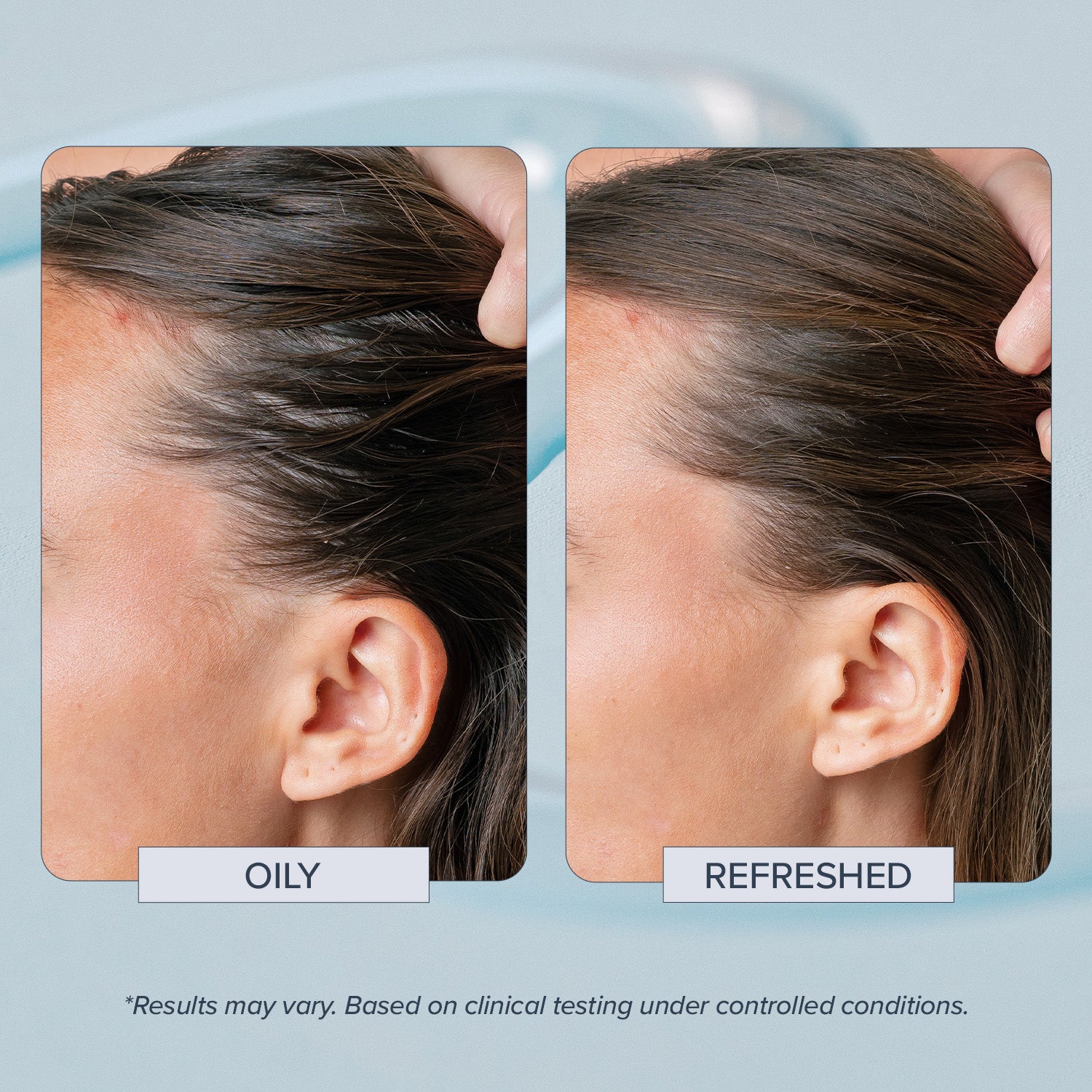 Head Start Scalp Ampoule
