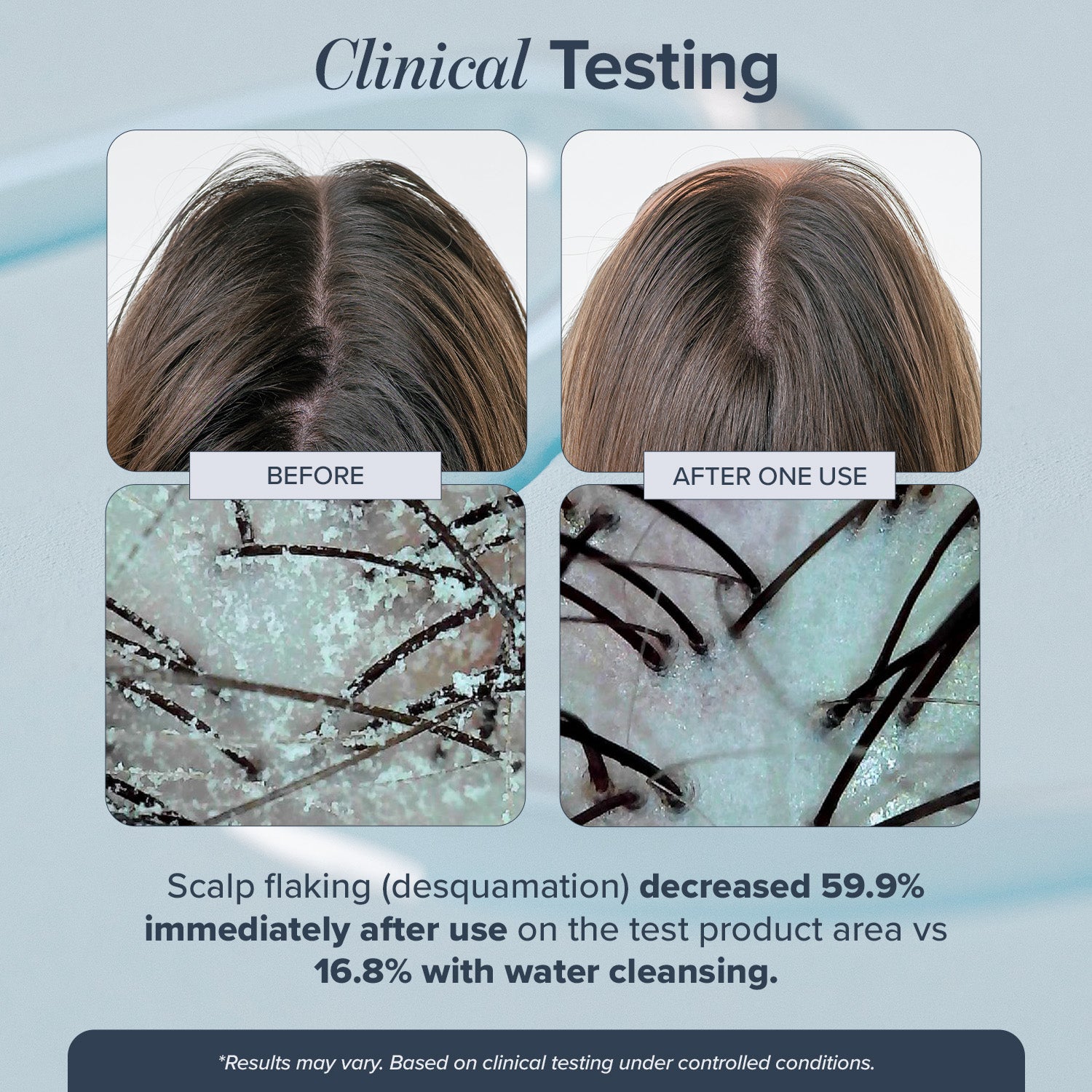 Head Start Scalp Ampoule