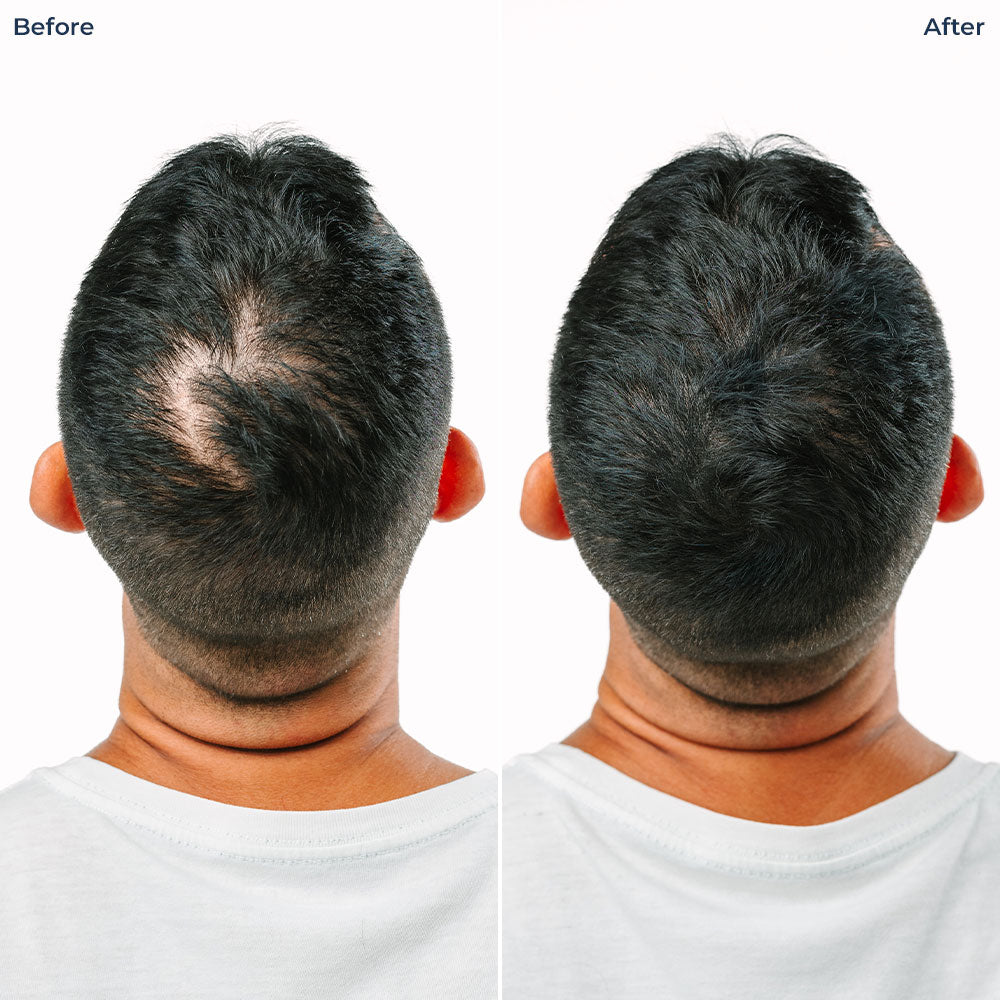 Color Fibers Root Coverage and Density Booster Refill