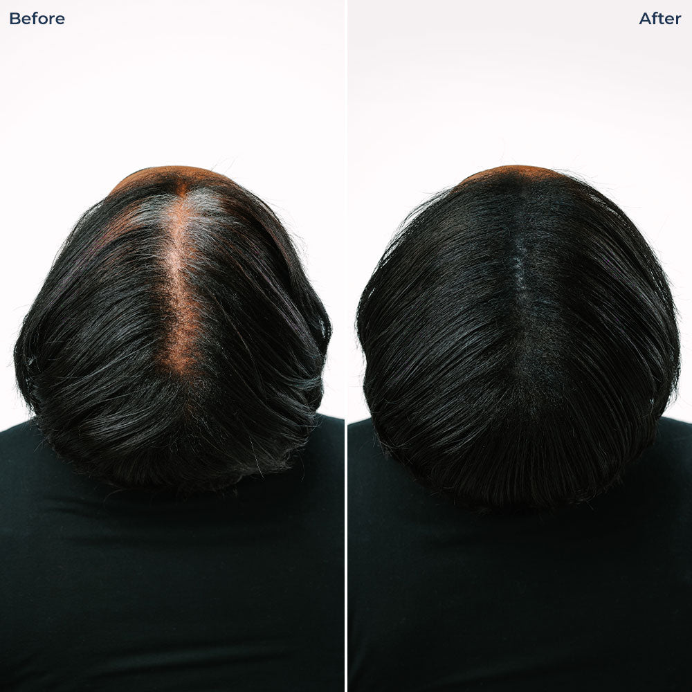 Color Fibers Root Coverage and Density Booster Refill