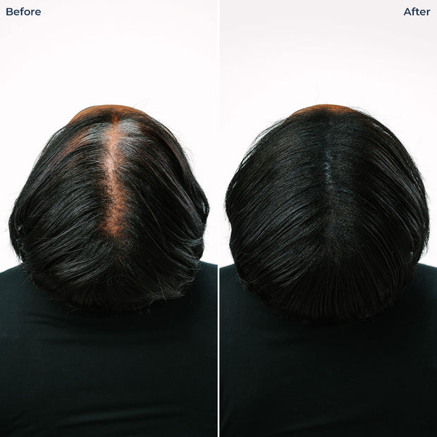 TRUHAIR Color Fibers Regular Root Coverage and Density Booster