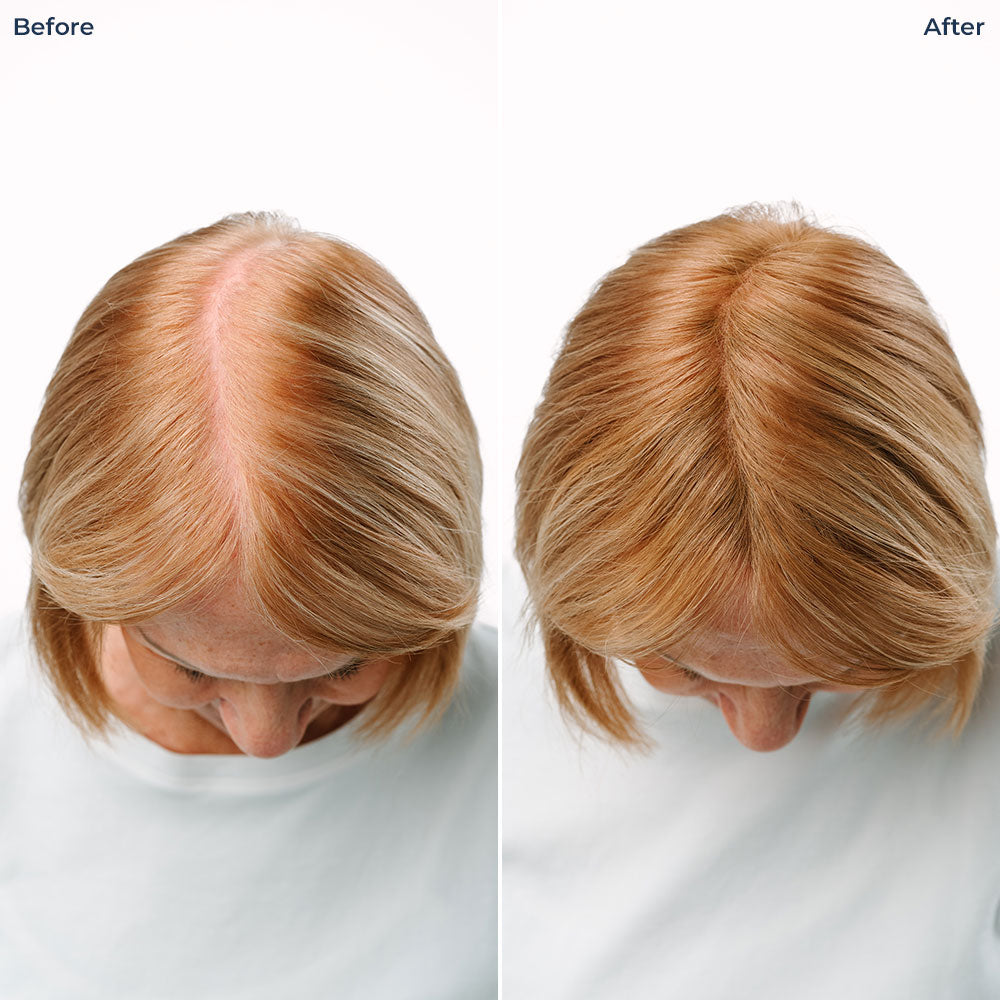 Color Fibers Root Coverage and Density Booster Refill