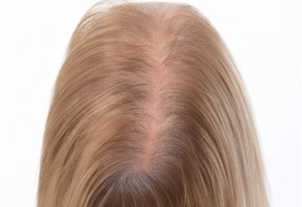 Widening part on light brown hair, before