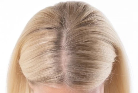 Scalp showing through fine blonde hair, before
