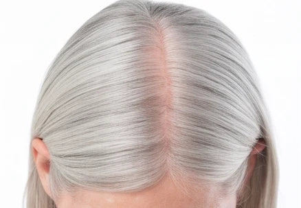 A wide part on gray hair with pink scalp showing through